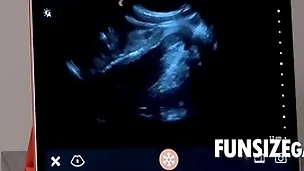 Ultra sound penetration probe - dr wolf, austin