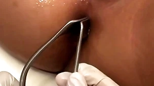 Asian patient penetrated less anal hole by stud less missionary