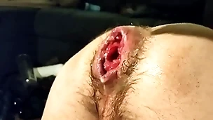 Unparalleled fisting my loose crevice and prolapse:)